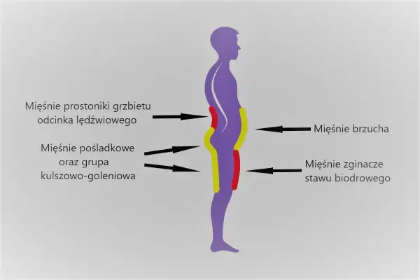 Lordoza lędźwiowa - kiedy jest problemem? Objawy i ćwiczenia